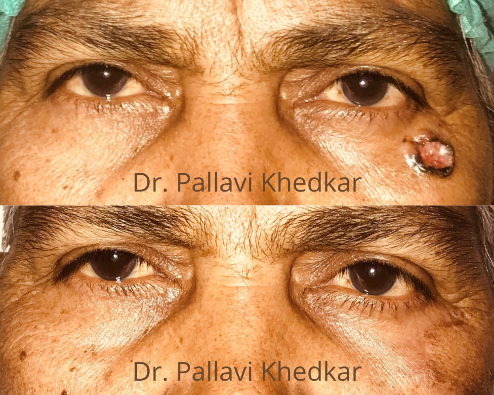 Eye Plastic Surgeon in Aurangabad- Dr. Pallavi Khedkar