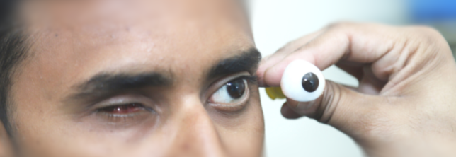 Artificial eye in Aurangabad - Shree Gajanan Eye Speciality Centre.